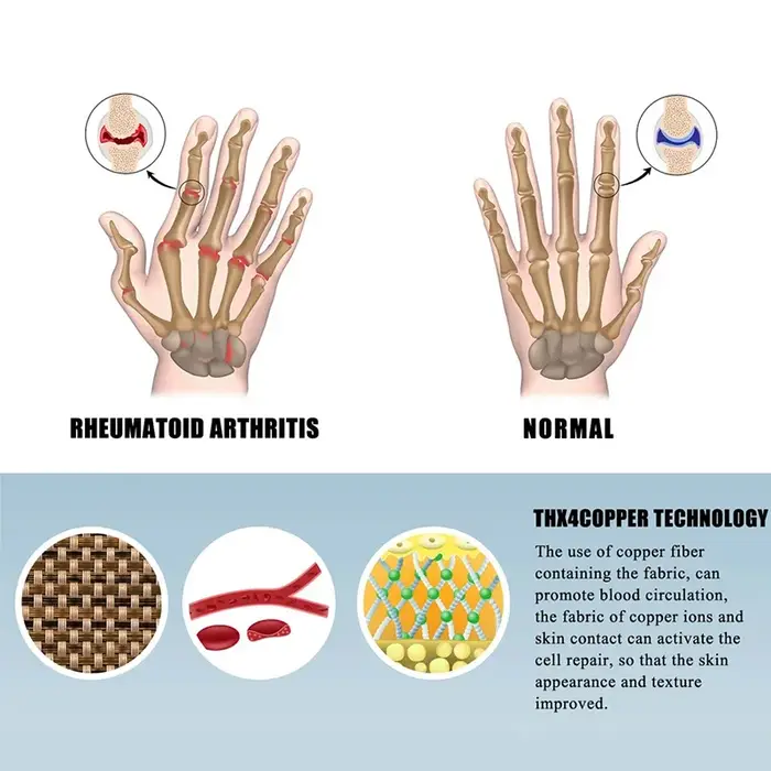 1 paire de gants pour l'arthrite, pour écran tactile, thérapie Anti-arthrite, gants de Compression e