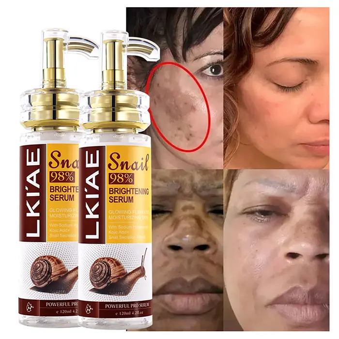 AILKE Sérum blanchissant à l'extrait d'escargot, hydratant, réduit les taches foncées, les rides, mê