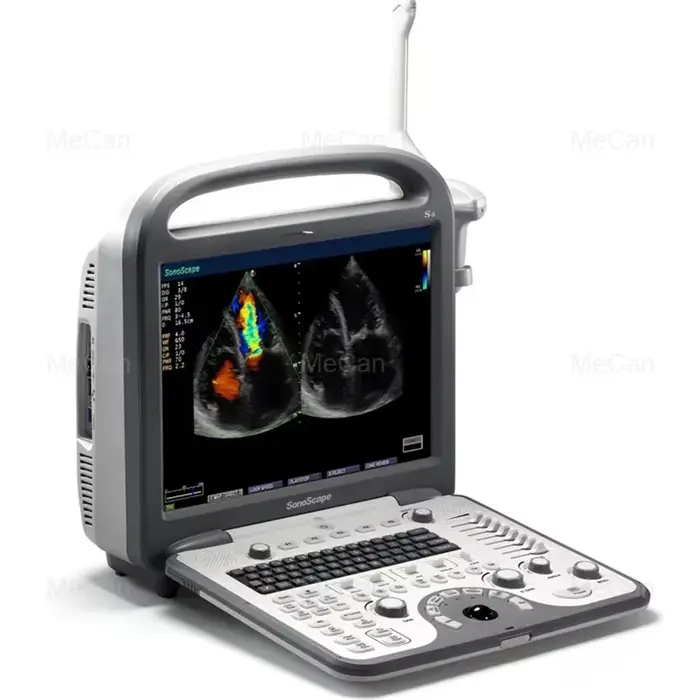 Échographe portable à main, prix, 3D, 4D, échographe portable, échographe Doppler, scanner à ultraso